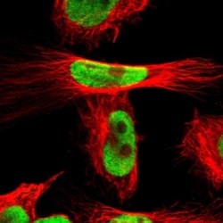 NCOR2 Antibody, Novus Biologicals 0.1mL; Unlabeled:Antibodies, Polyclonal